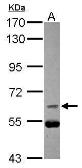 Anti-CDC25B antibody [C1C3] used in Western Blot (WB). GTX113331