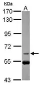 Anti-CDC25B antibody [C1C3] used in Western Blot (WB). GTX113331