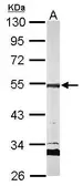 Anti-AP2M1 antibody used in Western Blot (WB). GTX113332