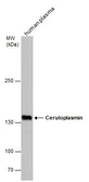 Anti-Ceruloplasmin antibody used in Western Blot (WB). GTX113333