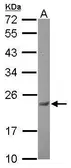 Anti-Casein Kinase 2 beta antibody used in Western Blot (WB). GTX113335