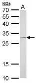 Anti-NQO1 antibody used in Western Blot (WB). GTX113336