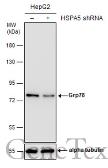 Anti-Grp78 antibody used in Western Blot (WB). GTX113340