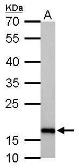 Anti-Stathmin 1 antibody used in Western Blot (WB). GTX113341