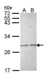Anti-Stathmin 1 antibody used in Western Blot (WB). GTX113341