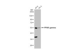 Anti-PPAR gamma antibody used in Western Blot (WB). GTX113344