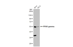Anti-PPAR gamma antibody used in Western Blot (WB). GTX113344