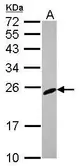Anti-RGS2 antibody [N1C3-3] used in Western Blot (WB). GTX113349