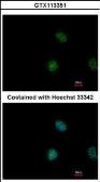 Anti-STAT5A antibody [C2C3], C-term used in Immunocytochemistry/ Immunofluorescence (ICC/IF). GTX113351