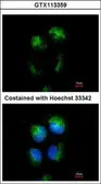 Anti-CD99 antibody used in Immunocytochemistry/ Immunofluorescence (ICC/IF). GTX113359