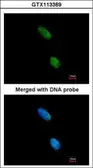 Anti-KIR3DL2 antibody used in Immunocytochemistry/ Immunofluorescence (ICC/IF). GTX113369