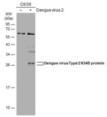 Anti-Dengue virus Type 2 NS4B protein antibody used in Western Blot (WB). GTX113374