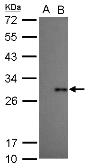 Anti-Dengue virus Type 2 NS4B protein antibody used in Western Blot (WB). GTX113374