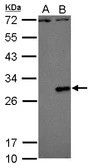 Anti-Dengue virus Type 2 NS4B protein antibody used in Western Blot (WB). GTX113375