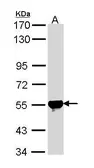 Anti-ALDH2 antibody [N1C1] used in Western Blot (WB). GTX113379