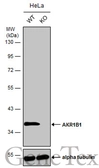 Anti-AKR1B1 antibody [N1C3] used in Western Blot (WB). GTX113381