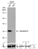 Anti-Annexin V antibody [N2C3] used in Western Blot (WB). GTX113384