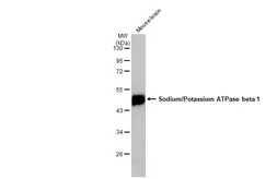 Anti-Sodium/Potassium ATPase beta 1 antibody used in Western Blot (WB). GTX113390