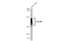 Anti-CEACAM1 antibody [N1N3] used in Western Blot (WB). GTX113392