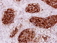 Anti-CEACAM1 antibody [N1N3] used in IHC (Paraffin sections) (IHC-P). GTX113392