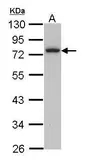 Anti-Calpain 3 antibody [C1C3] used in Western Blot (WB). GTX113398