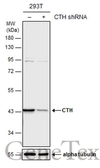Anti-CTH antibody used in Western Blot (WB). GTX113409