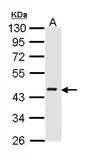 Anti-ICAD antibody [N2C3] used in Western Blot (WB). GTX113416