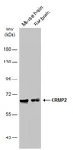 Anti-CRMP2 antibody [N1N3] used in Western Blot (WB). GTX113420