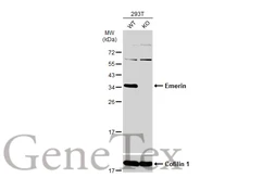 Anti-Emerin antibody used in Western Blot (WB). GTX113427