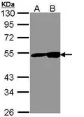 Anti-NSE antibody [C1C3] used in Western Blot (WB). GTX113428