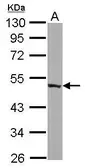 Anti-ENO3 antibody used in Western Blot (WB). GTX113429