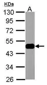 Anti-ENO3 antibody used in Western Blot (WB). GTX113429