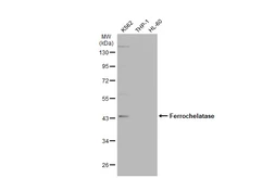 Anti-Ferrochelatase antibody [N2C3] used in Western Blot (WB). GTX113435