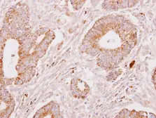 Anti-Fibrinogen gamma antibody used in IHC (Paraffin sections) (IHC-P). GTX113436