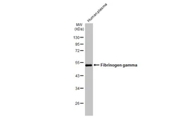 Anti-Fibrinogen gamma antibody used in Western Blot (WB). GTX113436