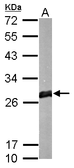 Anti-GSTM1 antibody used in Western Blot (WB). GTX113448