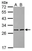 Anti-ERAB antibody [N1C3] used in Western Blot (WB). GTX113454