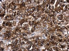 Anti-HLA-DR antibody [N2C3] used in IHC (Paraffin sections) (IHC-P). GTX113459