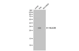 Anti-HLA-DR antibody [N2C3] used in Western Blot (WB). GTX113459