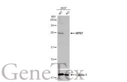 Anti-HPRT antibody used in Western Blot (WB). GTX113466