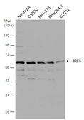 Anti-IRF5 antibody [N1C1] used in Western Blot (WB). GTX113477