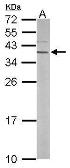 Anti-RPSA antibody [N2C3] used in Western Blot (WB). GTX113485