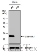 Anti-Galectin 3 antibody used in Western Blot (WB). GTX113486