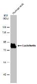 Anti-Lactoferrin antibody used in Western Blot (WB). GTX113488