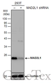 Anti-MAD2L1 antibody [N1C3] used in Western Blot (WB). GTX113489