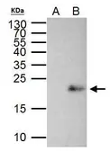 Anti-MAX antibody used in Immunoprecipitation (IP). GTX113492