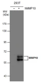 Anti-MMP10 antibody [N1C1] used in Western Blot (WB). GTX113496
