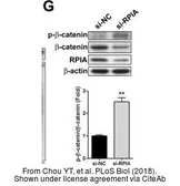 Anti-beta Catenin (phospho Ser33/Ser37) antibody [BC-22] used in Western Blot (WB). GTX11350