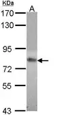 Anti-MTHFR antibody [N1N3] used in Western Blot (WB). GTX113500