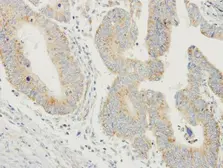 Anti-ProDynorphin antibody [N1C2] used in IHC (Paraffin sections) (IHC-P). GTX113515